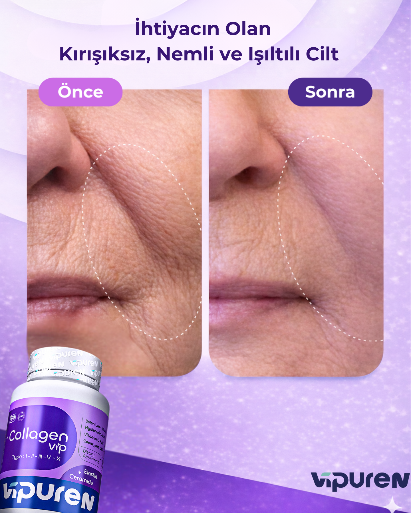 Vipuren - Collagen Vip | %100 Saf 5 Tip Kolajen , Vitamin + Mineral