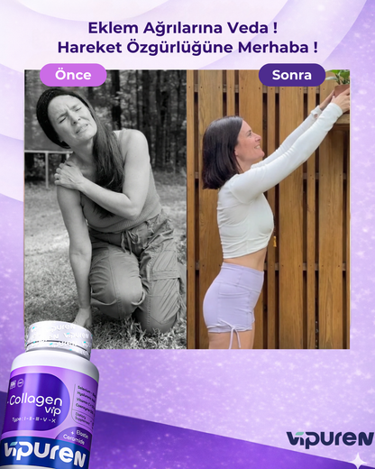 Vipuren - Collagen Vip | %100 Saf 5 Tip Kolajen , Vitamin + Mineral