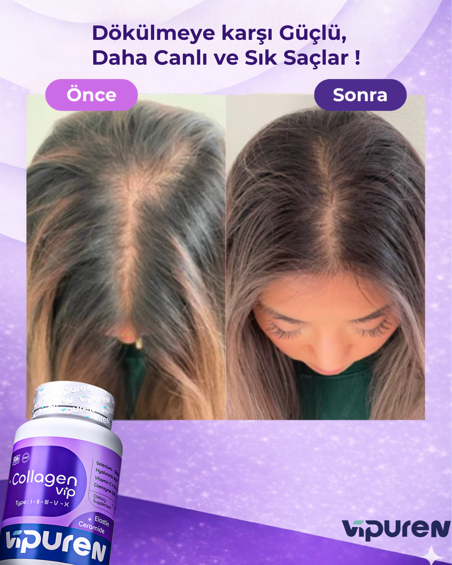 Vipuren - Collagen Vip | %100 Saf 5 Tip Kolajen , Vitamin + Mineral