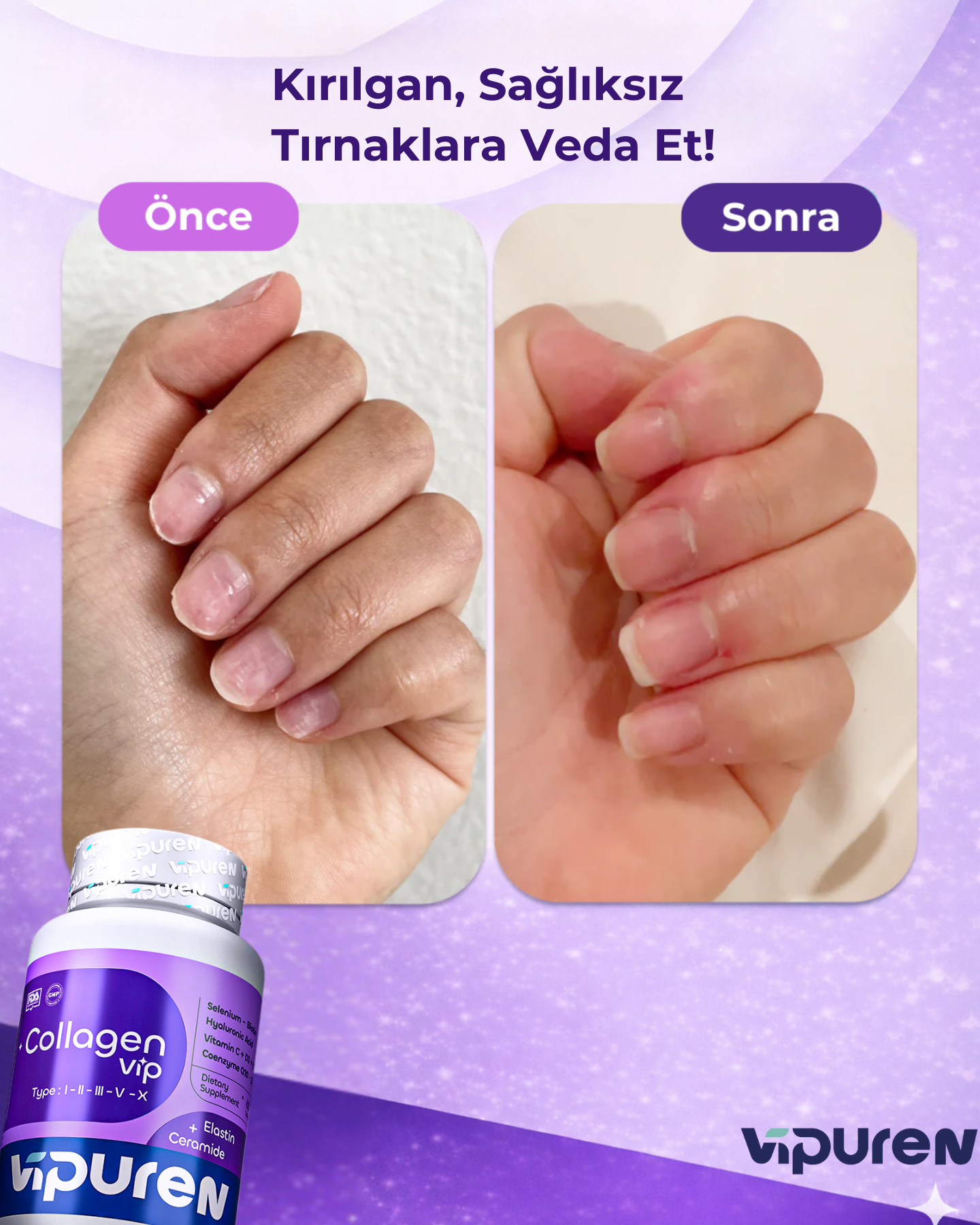 Vipuren - Collagen Vip | %100 Saf 5 Tip Kolajen , Vitamin + Mineral